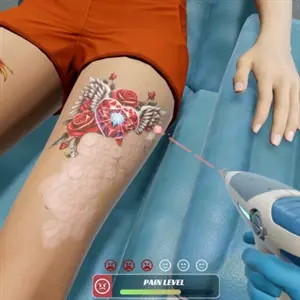 Tattoo Removal Simulator - Pain Level